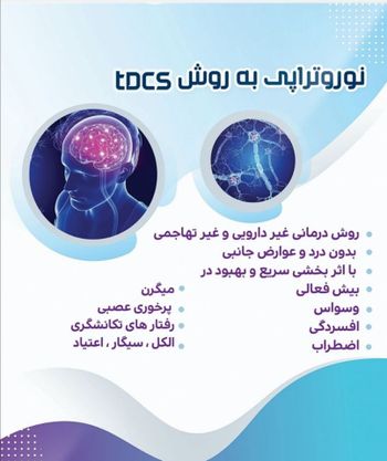 متد tdcs در درمان انواع اختلالات